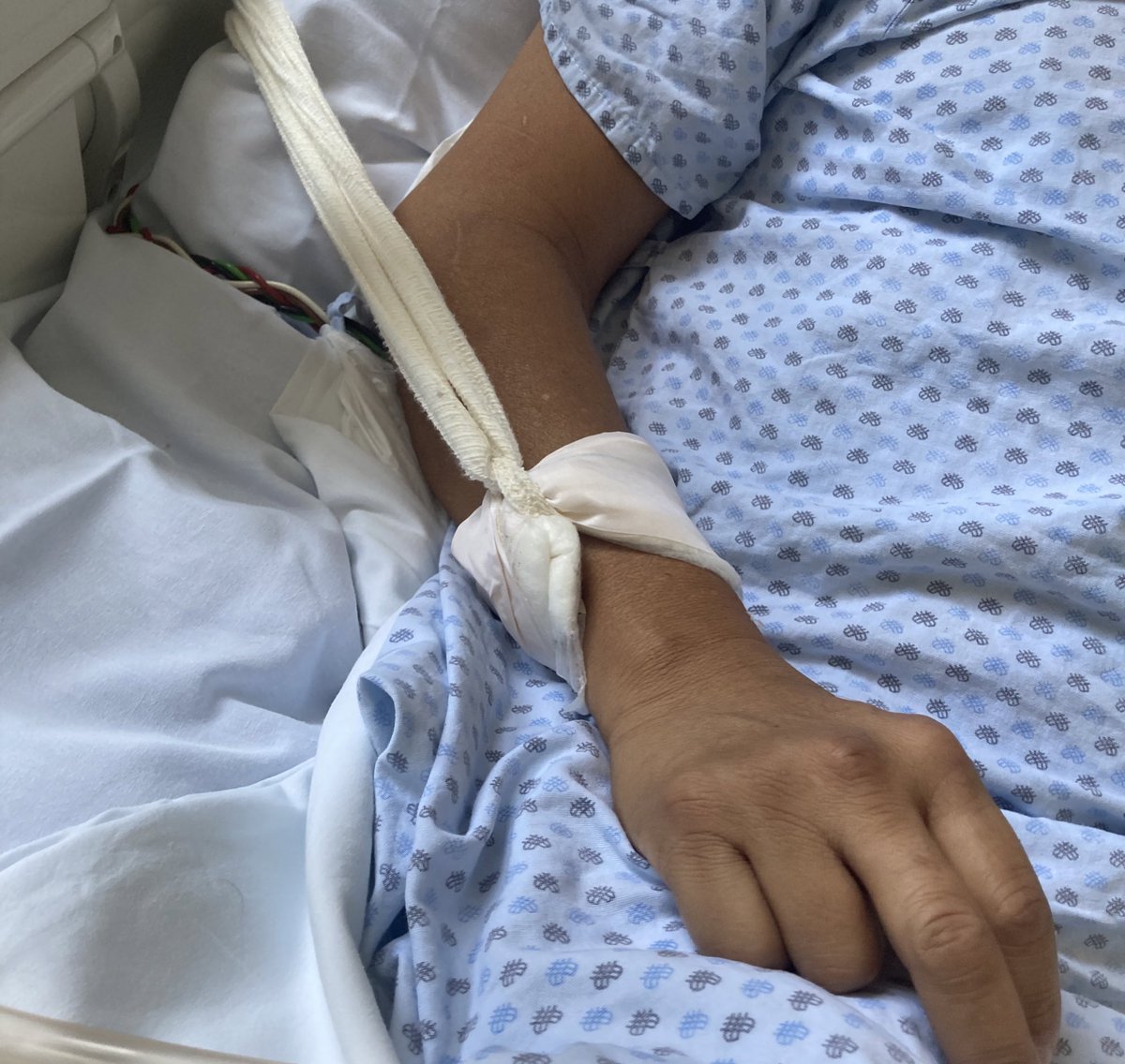 RobJonesBaro's tweet photo. La práctica más deshumana y arraigada a la UCI.
Son pocos los pacientes que realmente ameritan ser sujetados.
Sujetar a un paciente que NO lo amerita, es violencia, promueve el delirium y detona dolor! https://t.co/OyLpHUrcKg