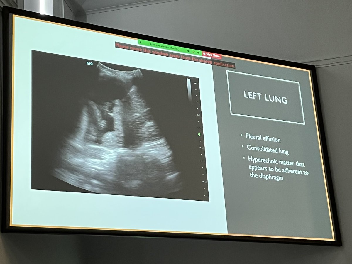 P2|Network tweet media