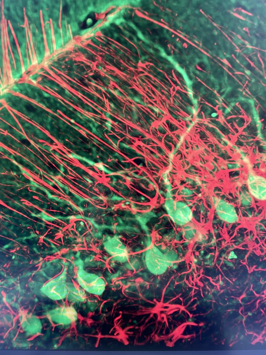 Collene Jeter (@collene_jeter) on Twitter photo Monday multiphoton quiz turned into Tuesday multiphoton quiz. Bonus if this is mutant or WT. <a href="/EKoutelou/">Dr. Evangelia (Lia) Koutelou</a> Monday multiphoton quiz turned into Tuesday multiphoton quiz. Bonus if this is mutant or WT. <a href="/EKoutelou/">Dr. Evangelia (Lia) Koutelou</a>
