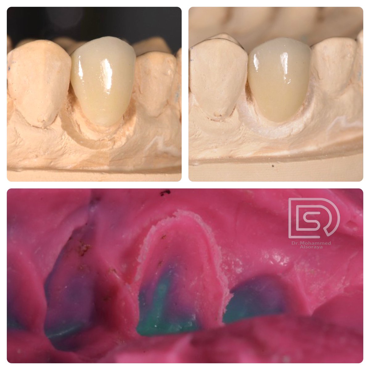 فينير لسن واحد فقط 😍🤍

instagram.com/p/CdYHZsyIGZ_/…