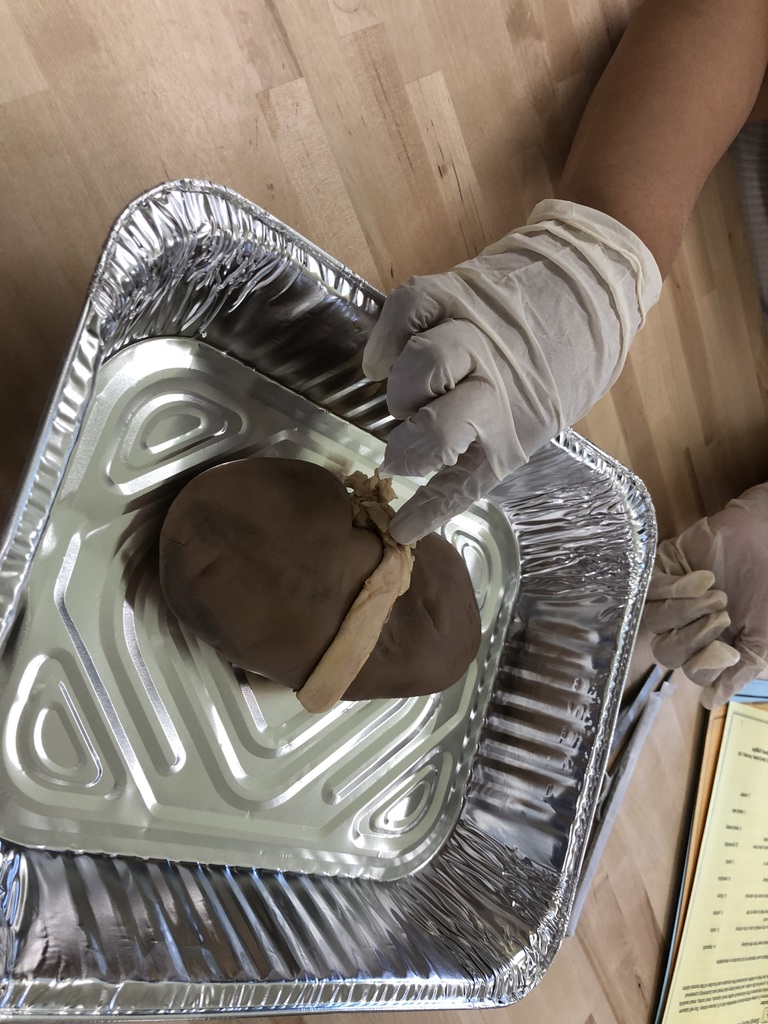 West Hempstead MS (@wh_msrams) on Twitter photo More pictures from our kidney dissection labs. Thanks to our WHHS science colleagues for taking a lead role in the dissections with our 8th graders. Teamwork! @whufsdrams #RamResolve <a href="/smurrayLB/">Sean Murray</a> More pictures from our kidney dissection labs. Thanks to our WHHS science colleagues for taking a lead role in the dissections with our 8th graders. Teamwork! @whufsdrams #RamResolve <a href="/smurrayLB/">Sean Murray</a>