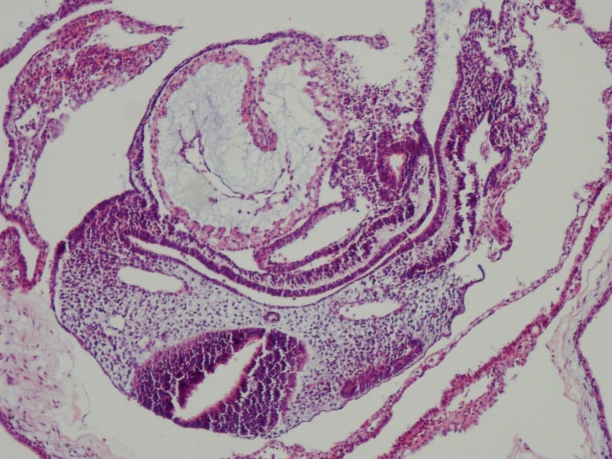 Early embryo. Like a picture of an embryology textbook. You can see neural crest, notochord, yolk sac and everybody🙃 #medstudents #embryology #PathTwitter #pathresidents