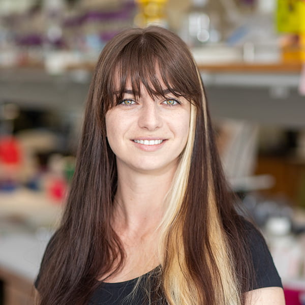 Giorgia Quadrato (@giorgiaquadrato) on Twitter photo 📢 Excited and proud to share our first preprint! We discovered a novel function for the autism-associated gene SYNGAP1 at the early stages of human cortical neurogenesis. Work co-lead by the very talented <a href="/MarcellaBirtele/">Marcella Birtele</a> postdoc and <a href="/DossoAshley/">Ashley Del Dosso</a> PhD candidate in our lab🧵 1/8 📢 Excited and proud to share our first preprint! We discovered a novel function for the autism-associated gene SYNGAP1 at the early stages of human cortical neurogenesis. Work co-lead by the very talented <a href="/MarcellaBirtele/">Marcella Birtele</a> postdoc and <a href="/DossoAshley/">Ashley Del Dosso</a> PhD candidate in our lab🧵 1/8