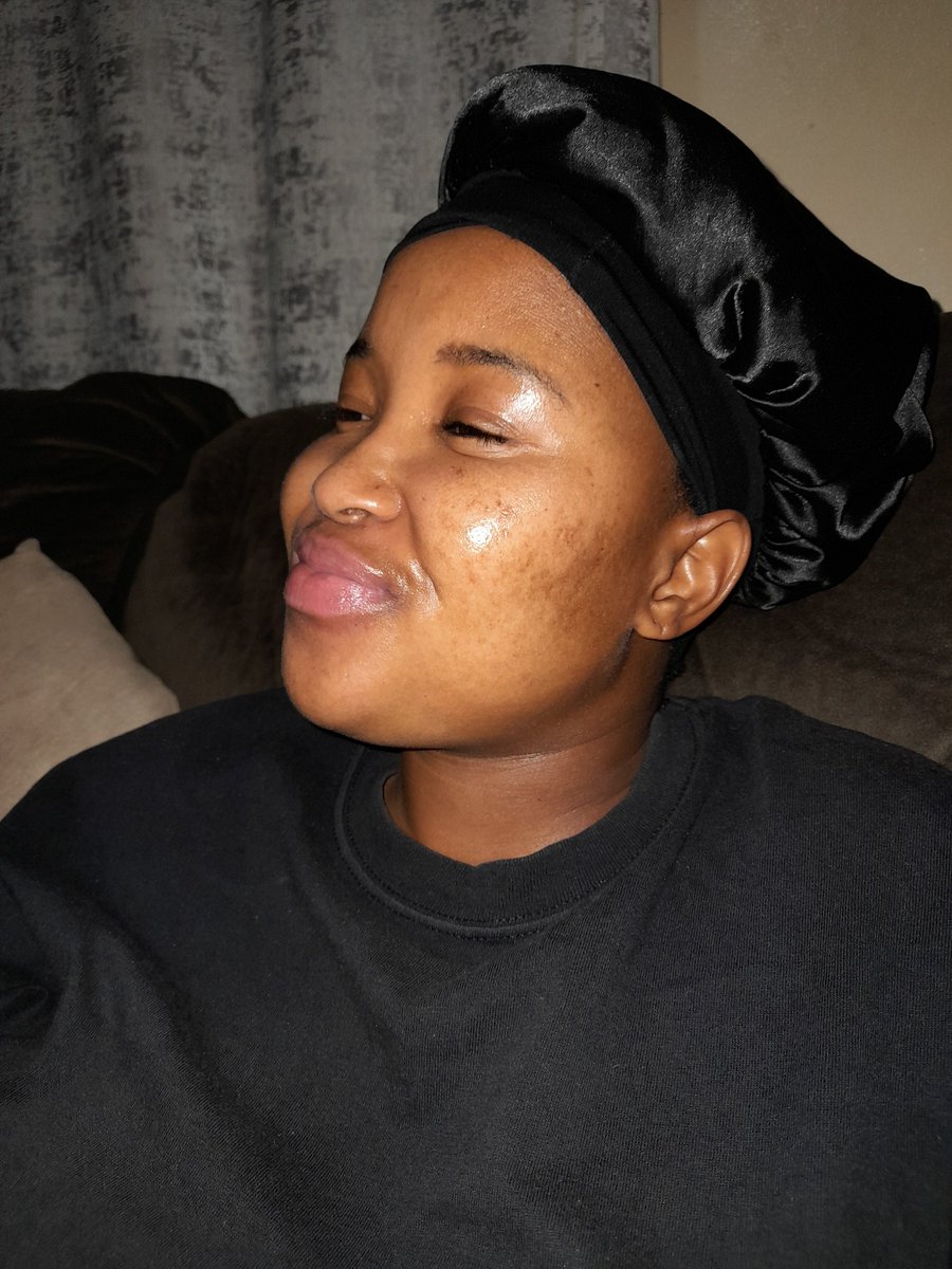 Amo_Mogale's tweet photo. Today marks 6months since I started my yourney with #acnetane it's been long & difficult having to deal with dry skin,iching,the exhausting,the mood swings ๐ญ bt I'm almost done #skinjourney .Now I need chemical peel to clear dackspot & my dry pain lips. https://t.co/b57qSBzHga