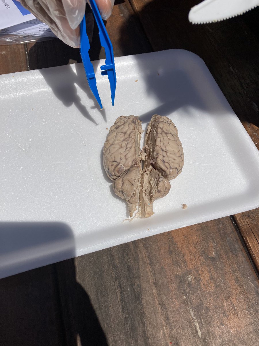 mtruslow_'s tweet photo. COOLEST. LESSON. EVER. Future neuroscientists of the world🧠 #SCOPESquad @SpotswoodElem https://t.co/6lwZnTsd8L