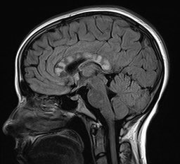 Lyell Jones MD tweet media