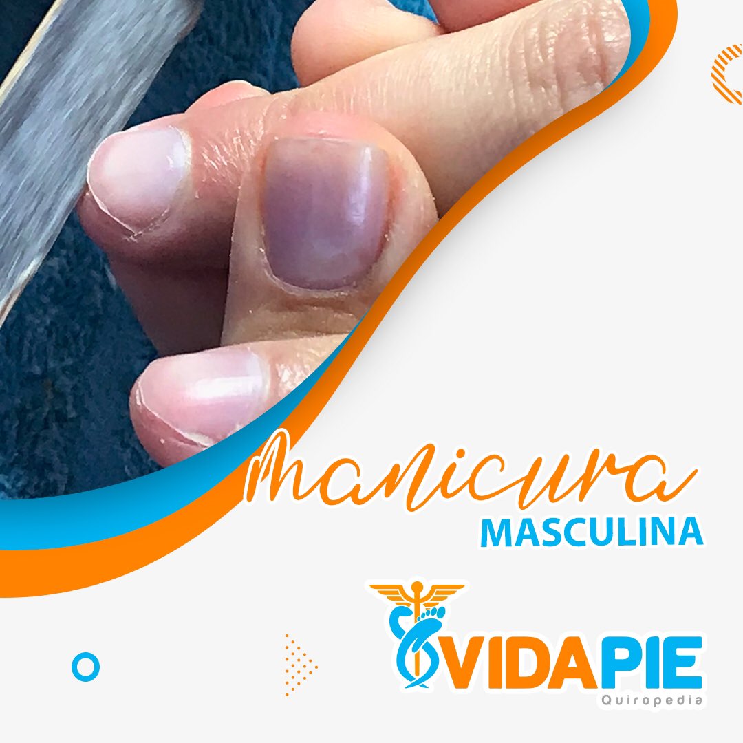En VidaPie ofrecemos tratamiento los efectivos contra la #onicomicosis atacando el problema de raíz.

También tenemos servicios de #manicura #masculina normal y especial dejando sus #manos estéticamente presentables.