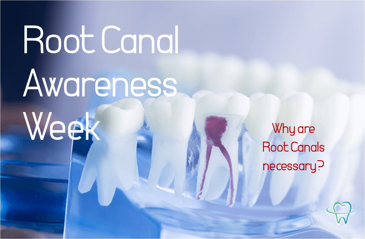 thetooth_dr's tweet photo. Happy Root Canal Awareness Week!!!
Root canals are necessary to save damaged, natural teeth and prevent the need for dental bridges and implants.
#flossdental #thetooth_dr #flossboss #gpsdental #rootcanalawarenessweek #bloomdentalofarlington #dentistry #trinidadandtobago https://t.co/3KrzlgedKy