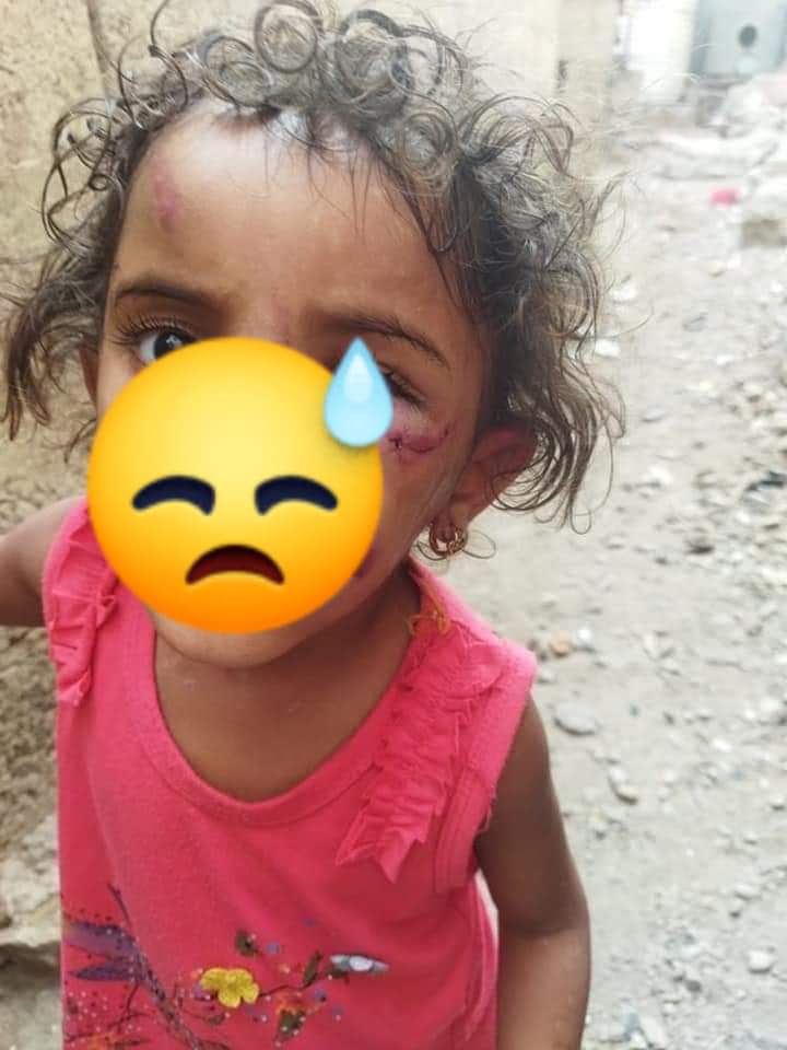 any_rwbyn's tweet photo. طفلة لا تتجاوز عمرها اربعة أعوام  تتعرض للضرب المبرح من والدتها تحت حجة ضياع قطعت ذهب وبعد الضرب المبرح لها دون تدخل الأب لنجدة ابنته يعترف الأب بأنه قام ببيع الذهب وكان شي لم يكن تم نجدة الطفلة بعد تدخل ابناء الحي الذين يسكنون فيه بعد سماعهم لبكاء الطفله في منطقة وادي المدام https://t.co/XcrWj0gK2t