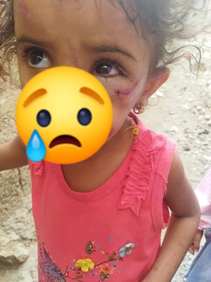 any_rwbyn's tweet photo. طفلة لا تتجاوز عمرها اربعة أعوام  تتعرض للضرب المبرح من والدتها تحت حجة ضياع قطعت ذهب وبعد الضرب المبرح لها دون تدخل الأب لنجدة ابنته يعترف الأب بأنه قام ببيع الذهب وكان شي لم يكن تم نجدة الطفلة بعد تدخل ابناء الحي الذين يسكنون فيه بعد سماعهم لبكاء الطفله في منطقة وادي المدام https://t.co/XcrWj0gK2t