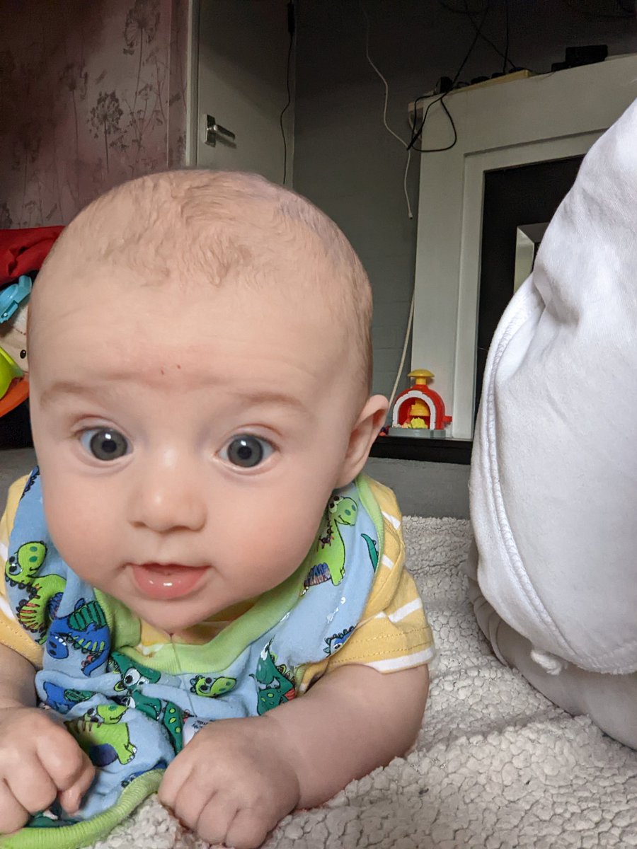 BethanS92's tweet photo. @ramen_chmait Just a positive to this just had my second baby, delivered him at 38 weeks and 5 days. 3 years after my fetal repair on my daughter whom I made it to 37w3d and didn't suffer uterine rupture on either nor show signs of issues and he was 9lb 2 Oz https://t.co/dIKU96VAFm