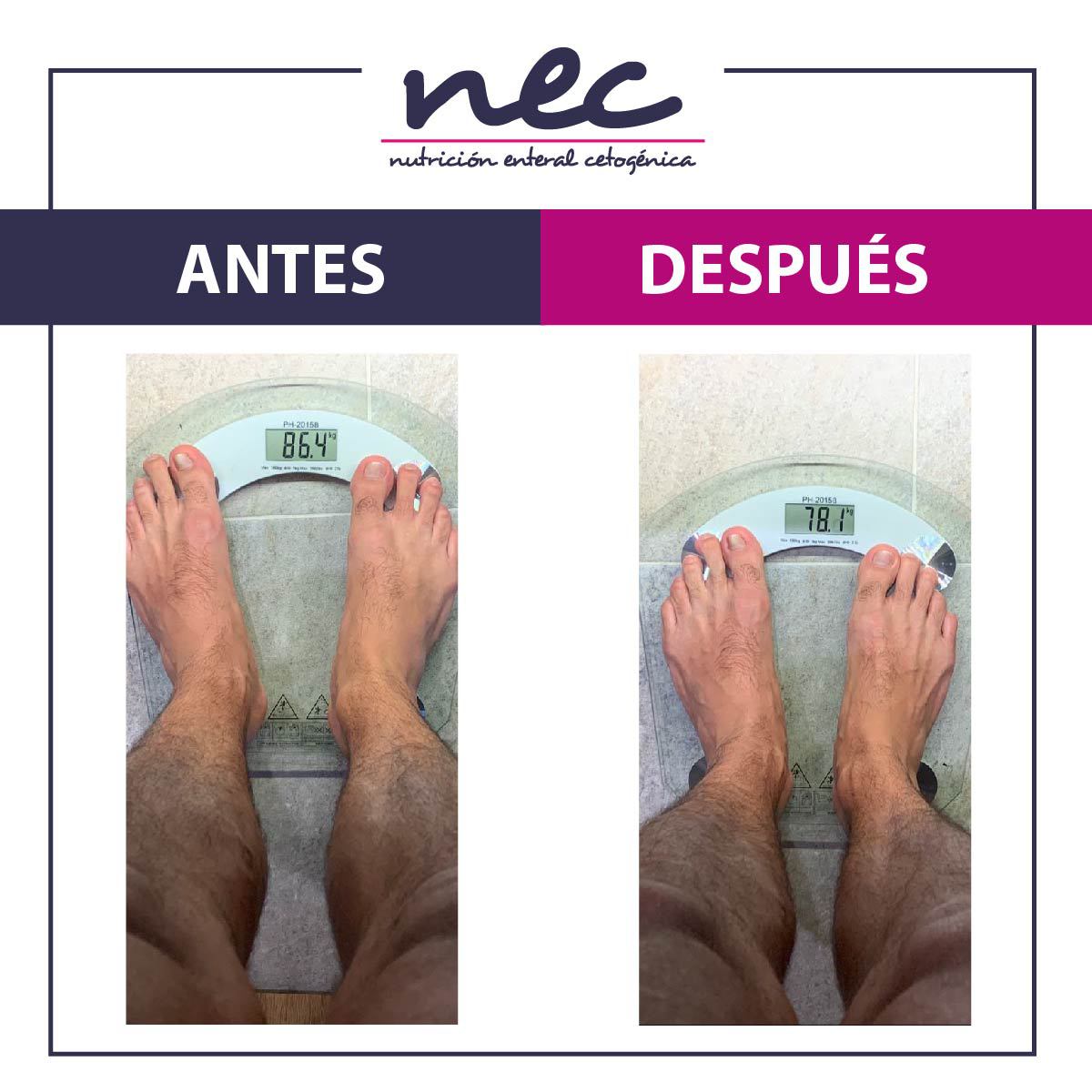 MetodoNec's tweet photo. ¡Resultados reales!

Con Método Nec en tan solo 10 días podrás alcanzar tu peso ideal de manera saludable, segura, confiable y sin cirugías. Para más información, déjanos tus datos en https://t.co/LRC2M1Apmm
-
#métodonec #bajardepeso #bajardepesorapido  #estilodevidasaludable https://t.co/BtRG0pinGP