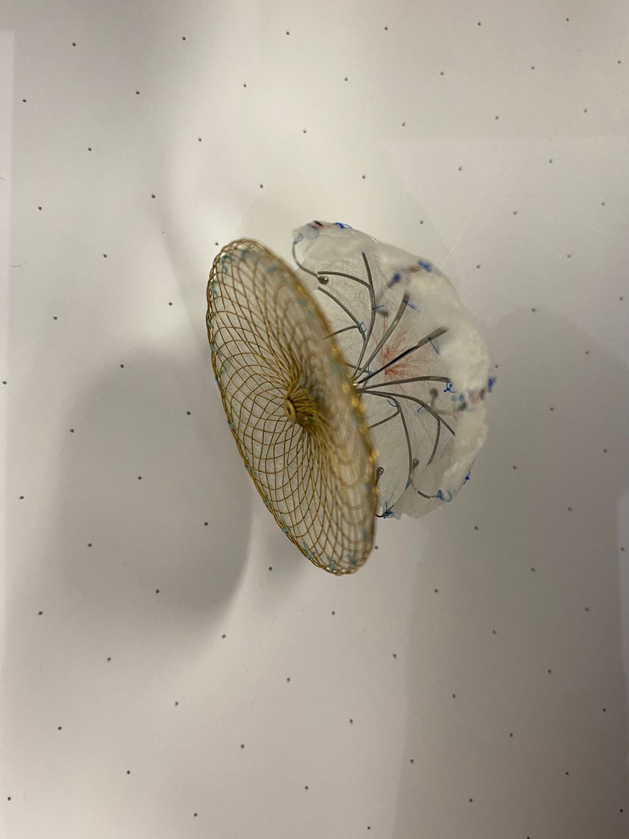 HemodinamicaC's tweet photo. Hoy en @HemodinamicaC Cierre complejo de orejuela con @icruzgonzalez !
👉🏻planificacion con ayuda de modelo 3D
👉🏻 impresionante resultado
#LAmbre #structuralHUN https://t.co/FIqqoA6VGf
