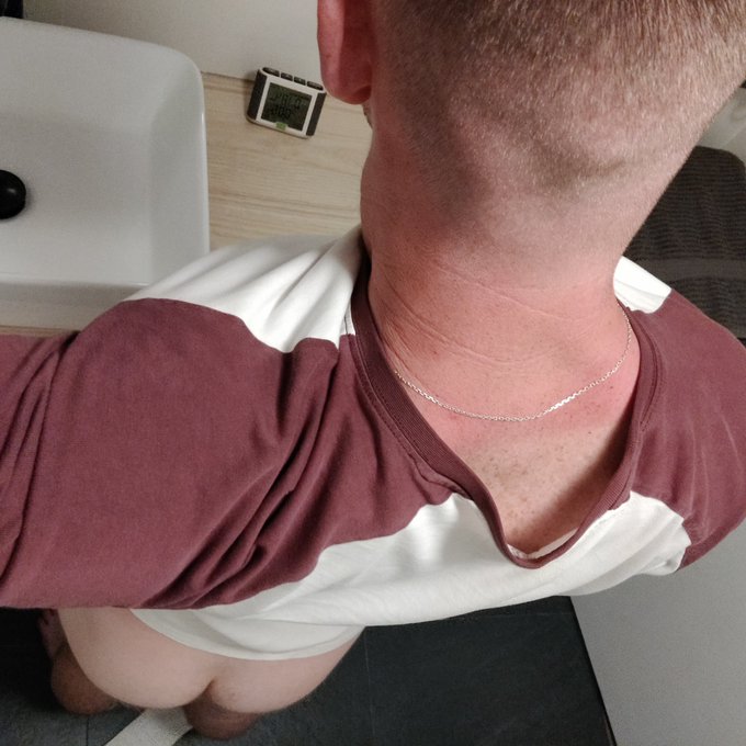 Burnt my neck today.. SUMMER IS HERE! ☀️😃 https://t.co/zcrhA4DWwv<a href="/tag/pits"class="tags"><span>#pits</span></a>