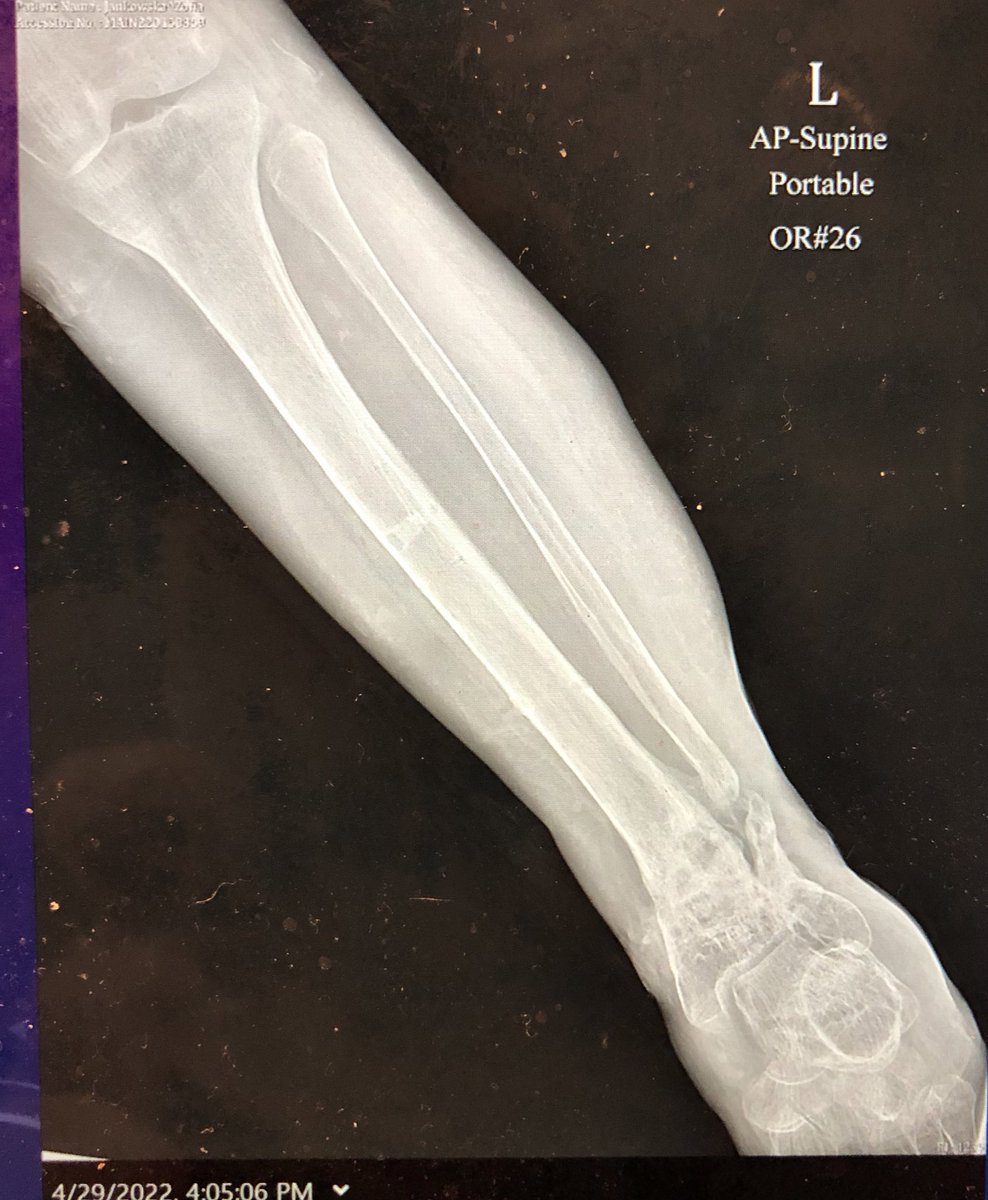 Some have asked for the x ray that goes with the wire frame.