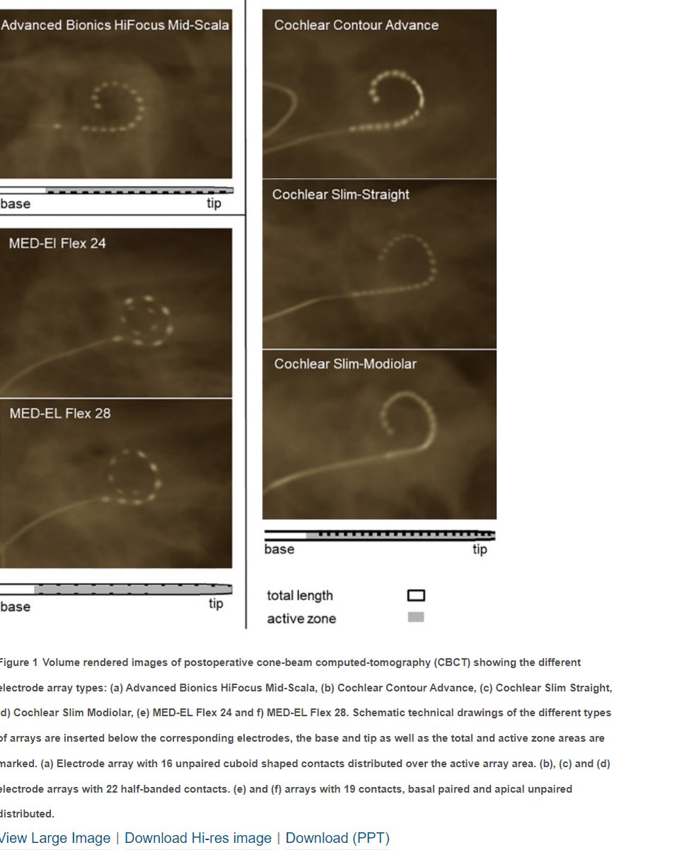 Intra-op x-ray done for cochlear implant: would you call the surgeon urgently? Majority implant electrodes don't show this gap between 1st and 2nd marker except:Advanced Bionics HiFocus Mid-Scala. 2nd fig from ref, good way to quickly check if in doubt. sciencedirect.com/science/articl…