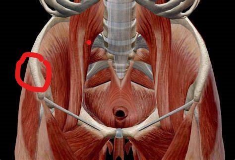 JoseLuisdelCura's tweet photo. Retomo la serie de casos con una patología poco conocida: la entesopatía de la inserción superior de la banda iliotibial.
Suele producir un dolor molesto y continuo en la cresta iliaca, en su zona externa (círculo rojo). https://t.co/F4wVrrtGvK