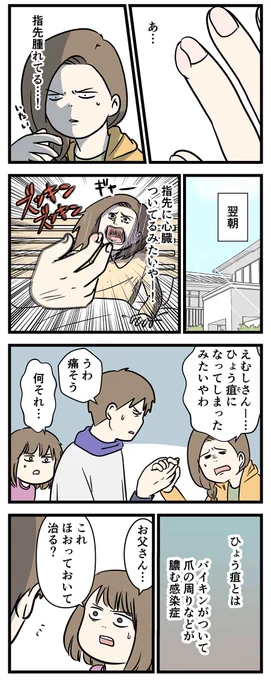 「ひょう疽」っていうヤバイ感染症になった時の話

#コミックエッセイ
#漫画が読めるハッシュタグ

なお、二人とももう治ってます 