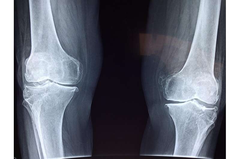 ASBMR's tweet photo. Osteoporosis in men overlooked by doctors and patients #ASBMR #BoneScienceNews 

https://t.co/auLGbQSfcA https://t.co/21eaTEvF3m