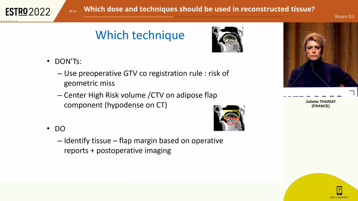 AiroHead_Neck's tweet photo. Back from #ESTRO2022. Interesting lecture from Dr. Thariat: in PORT, no need to sistematically cover the entire flap with >60 Gy. Cover the junction areas. Under investigation the spare of the inner portion https://t.co/w16DNc9bAe