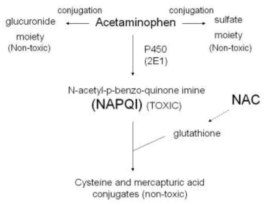 Overdose acetaminophen --> metabolism by liver enzymes "fills up" (saturated) --> excess acetaminophen metabolized by P450 system enzymes --> toxic NAPQI, quinonimine produced --> liver necrosis, zone 3 predominant (high levels of Overdose acetaminophen --> metabolism by liver enzymes "fills up" (saturated) --> excess acetaminophen metabolized by P450 system enzymes --> toxic NAPQI, quinonimine produced --> liver necrosis, zone 3 predominant (high levels of