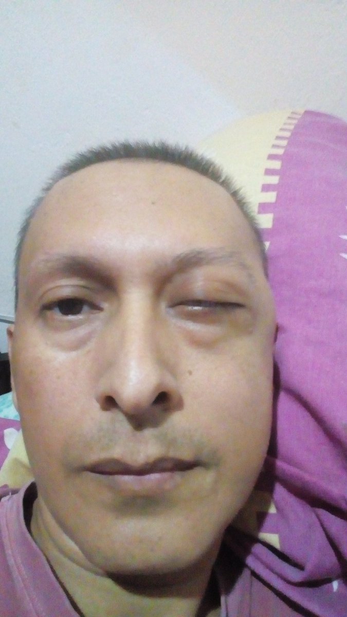 ALBERTO46665323's tweet photo. .@NicolasMaduro Los Pacientes Oncológicos nos estamos MURIENDO no hay #RadioterapiaCabezaYCuello en los centros de salud pública...  @minsaludve  @magalygutierrezv solicitamos su ayuda con la grave situación que estamos afrontando @gestionperfecta @delcyrodriguezv @TareckPSUV https://t.co/LNVSbHrvbB