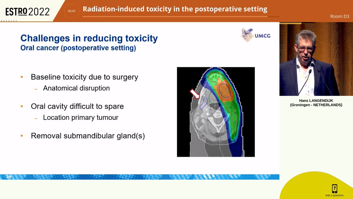 AiroHead_Neck's tweet photo. Back from #ESTRO2022. Beautiful lecture from Dr. Langendijk about radiation induced toxicity in oral cavity PORT. Limiting target volumes and new radiation techniques could help reduce toxicities. Spare the oral cavity! https://t.co/8G5MjvJlOk