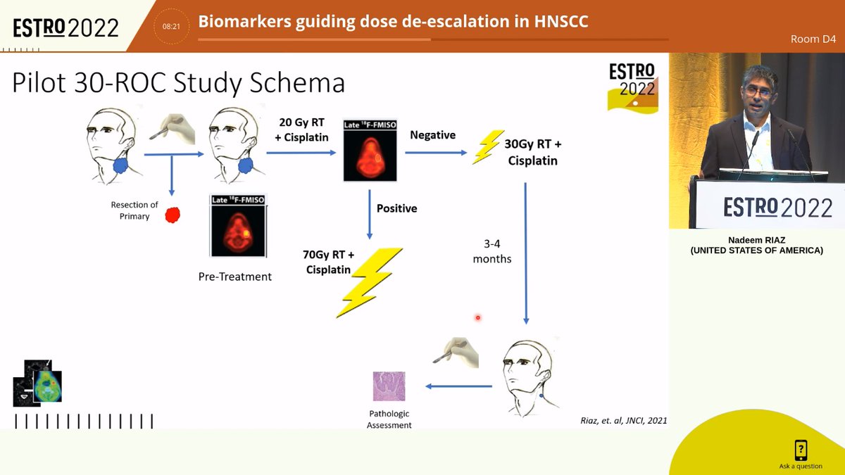 AiroHead_Neck's tweet photo. It's hard to summarize the brilliant lecture from Dr. Riaz. Intra-treatment imaging, cfDNA, pre-therapy anti-tumor immunity and viral agents could lead the way to de-escalation in HNSCC. Total dose of 30 Gy + cisplatin sounds very interesting. Back from #ESTRO2022 https://t.co/j6H7LywgFK