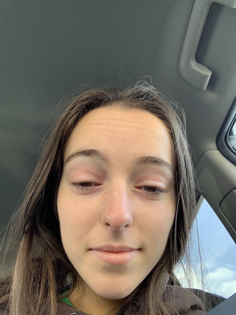 Decided to call it quits on my AP test and take a nap face down on the desk. Woke up the next day with double pink eye.  #lastnightasamacconfessions