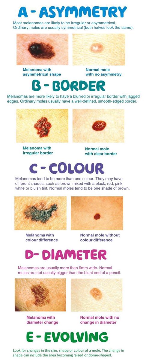 It is important to check your moles on a regular basis for any changes. Key factors to keep in mind are asymmetry, borders, colour, diameter and evolution. If you have any concerns, be sure to speak to your healthcare provider. #besunsafe #PublicHealthMatters