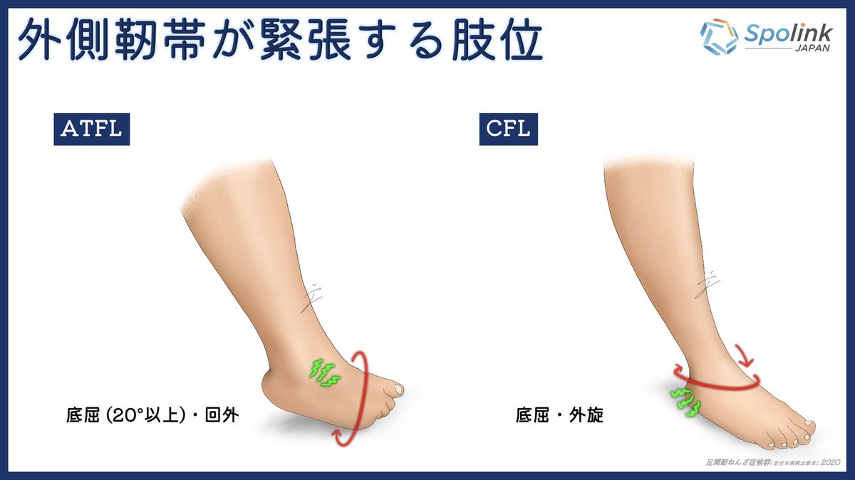تويتر 足関節捻挫 بحث تويتر