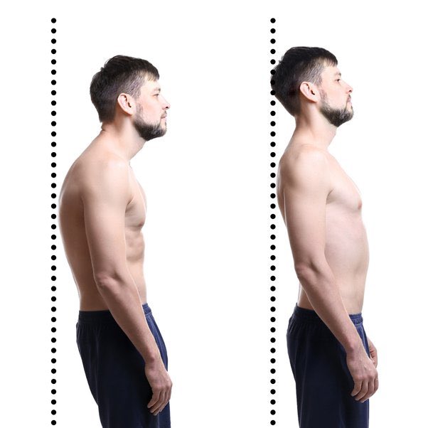 يعاني بعض الأشخاص من "انحناء الأكتاف للأمام" (Rounded shoulders) نتيجةً
