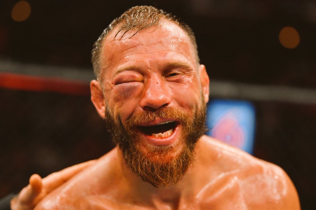 MegaLD's tweet photo. Who wore it better 
@Cowboycerrone
I should of never blew my nose
#sparing#kickboxing https://t.co/xhsa0D5WIg