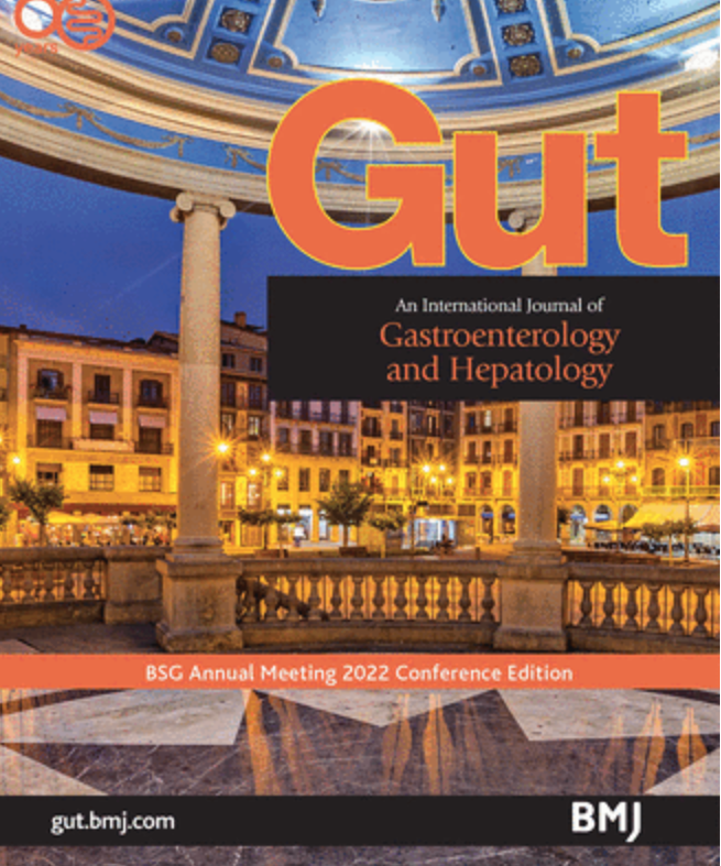 Gut_BMJ's tweet photo. Plaza del Castillo square in Pamplona, Spain. @Areche_M et al report on next-generation sequencing of bile cell-free DNA for the early detection of malignant biliary strictures via https://t.co/r41tPUIeNC

@daniel_oyon @LennyNelson15 @CUBEROlab @pottoberasain @AESPANC  @juanjvila https://t.co/vvpzeZdz6z