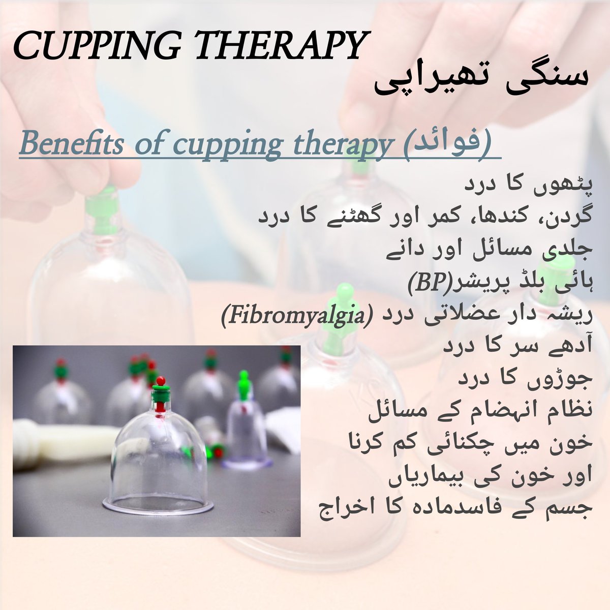 JamilMuskan's tweet photo. #RA #painrelief #cupping #cuppingtherapy #cuppingtherapist #cuppingmassage #JointsPain #musclespain #HighBP #arthritis #hijama #hijamacupping #hijamatherapy #acnetreatment #acnecontrol  #sciaticarelief #physiotherapytreatment #lahorephysiotherapyclinic #PhysiotherapistInLahore https://t.co/npKA3YuFI1