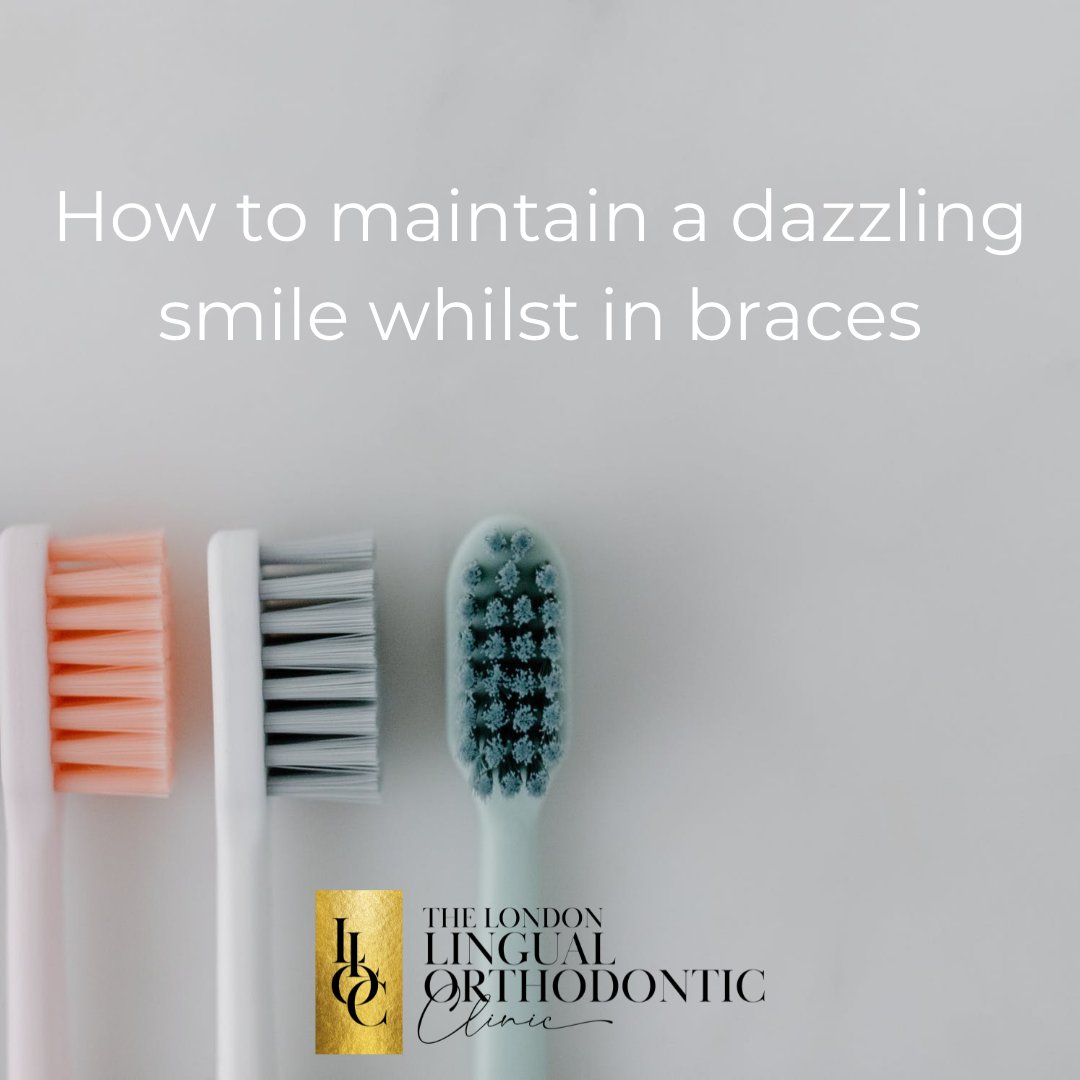 Here are some of our top tips to help you maintain a dazzling smile whilst wearing #braces:
⚫Keep hydrated🚰
⚫Establish a thorough daily cleaning routine
⚫Carry an oral ‘travel’ kit🧳

Learn more from our blog:
ow.ly/u6rT30sjtLq