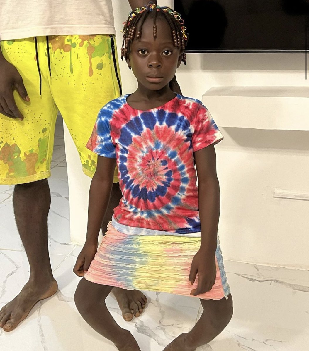 HealingLiberia's tweet photo. Four months after her first surgery, Marthaline has fully healed and is back in Nimba with her friends and family. Thank you Dr. James Appel for the amazing work as always and thanks to Marthaline’s dad J Melvin Larquoi Sr. for the care and dedication. https://t.co/Aj9LHxvQ72