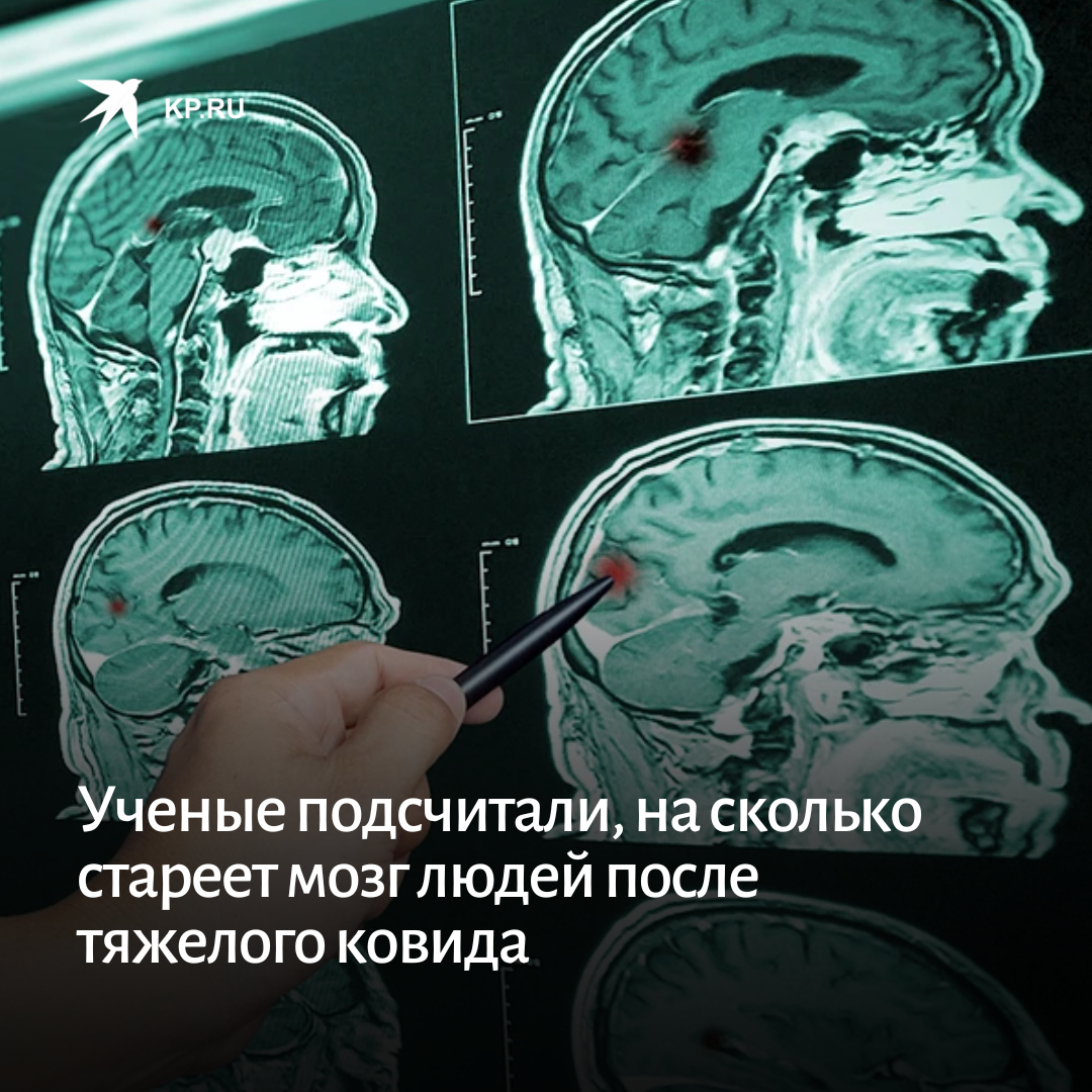 Ковид мозговой туман. Мозговой туман после коронавируса. Исследование мозга ученых показал. Сбои в мозговой деятельности человека.