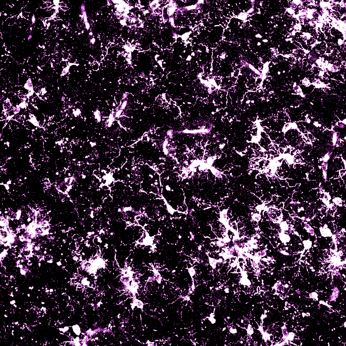 SinaiBrain's tweet photo. .@CarmenRomM's STUNNING IMAGE " #Microglia in #AlzheimersDisease" shows #ImmuneCells in the #Brain fighting against #AlzheimersDisease pathology. #GoateLab #ArtoftheBrain image #7 VOTE NOW/MOST 🥰s WINS https://t.co/o5cyvcJsjh