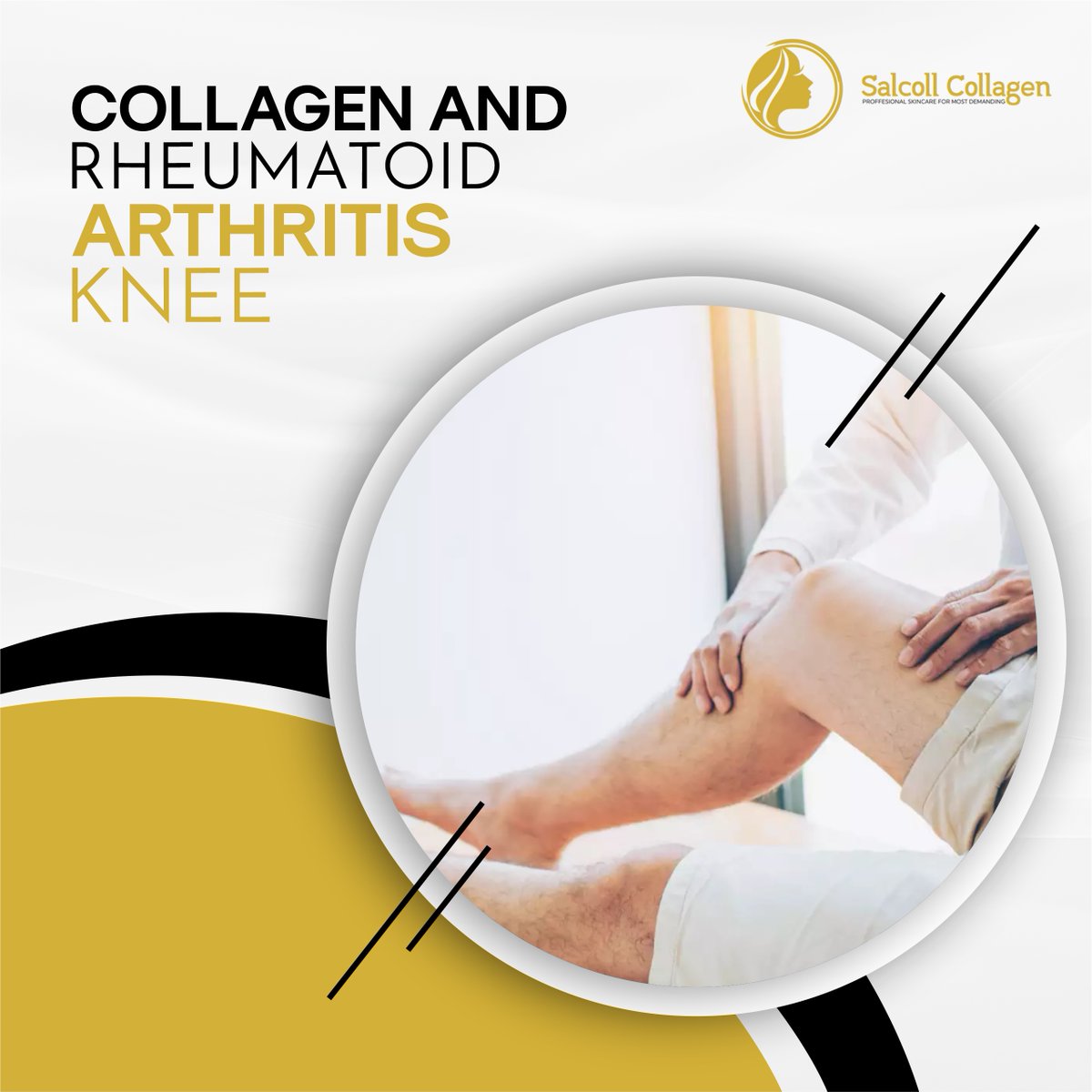 OfficeSalcoll's tweet photo. Rheumatoid arthritis knee results in lower joint mobility, severe pain, and diminished life quality. The pharmaceutical industry is flooded with rheumatoid arthritis knee medicines.
------
Blog link: https://t.co/skKycFxb51
.
#salcollcollagen #knee #kneepain #physiotherapy https://t.co/bCwHxSWQ2n