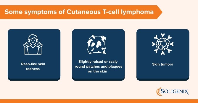 Soligenix_Inc's tweet photo. Cutaneous T-cell lymphoma is a rare disease affecting approximately 20,000 Americans. Symptoms include rash-like skin redness, slightly raised or scaly round patches and plaques on the skin, and skin tumors. For more information: https://t.co/rYwxsplsAA #ctcl #soligenix https://t.co/C09geSpIc7