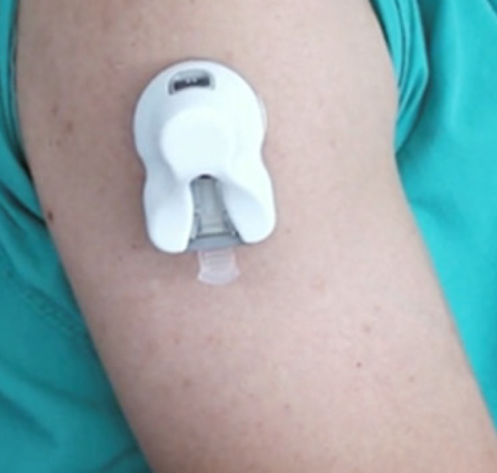 albert_koulman's tweet photo. Remote blood sampling is the future. You can ask people to run up the stairs and stick their hand in warm water to get enough blood out of a finger tip. Or use new technology. @MRC_Epid we used the Onedraw. https://t.co/FL1jyh1BAW