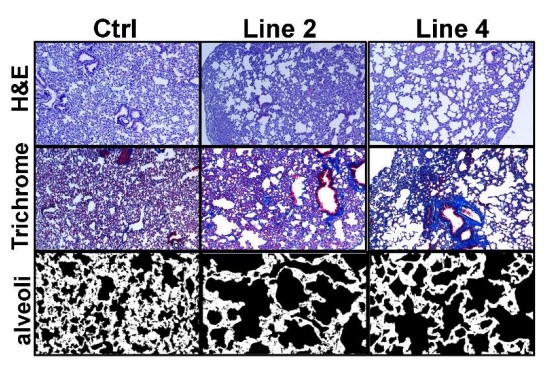 MCR_AACR's tweet photo. Pro-survival #Caspase-9b isoform activates NF-kB pathway and modulates lung inflammation, immune cell influx, and peripheral immune responses. It is a key factor driving #CellTransformation and #LungTumorigenesis, Kim et al.
https://t.co/5AbLIFFiBR
@gamze_b_bulut @raghupillappa https://t.co/mnvcgRub3B