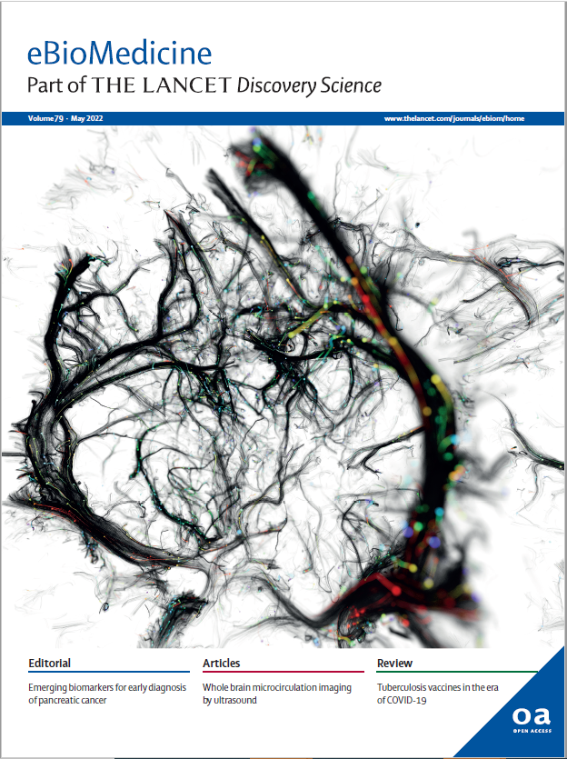 eBioMedicine's tweet photo. Our May issue is now online! Stay tuned for some highlights. 
Register for content alerts https://t.co/7EWoaSSqz0 

#SARSCoV2 #ultrasound #AirPollution #cancer #gutmicrobiome among other exciting research all #openaccess

Table of contents: https://t.co/yhMvsFit3z https://t.co/gccNTKAAQv