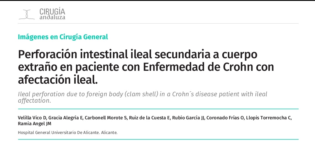davelilla92's tweet photo. Nuevo artículo publicado en el último número de Cirugía Andaluza! Cuidado con las almejas! @aecformacion @aecirujanos #SoMe4Surgery https://t.co/stLt60Dy2J