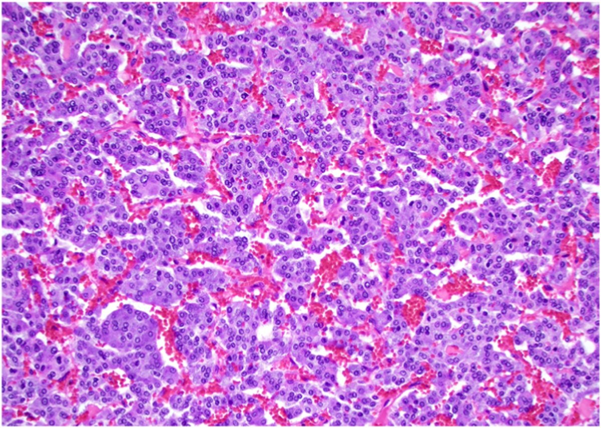 Urology Case Reports tweet media