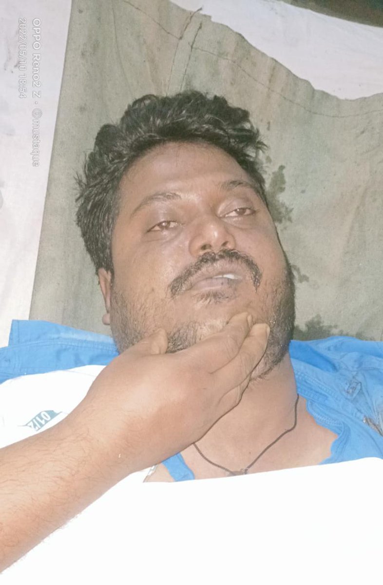 vkk403's tweet photo. KGP/DIV
INCIDENCE:  Amitesh Biswas/KGP became severe injured while checking CBC of Cab-1 side(HWH End) Loco moved &amp; pressed  Sr ALP –Amitesh Biswas at about 18:05hrs), he dead in hospital. https://t.co/a3BiBoHfml