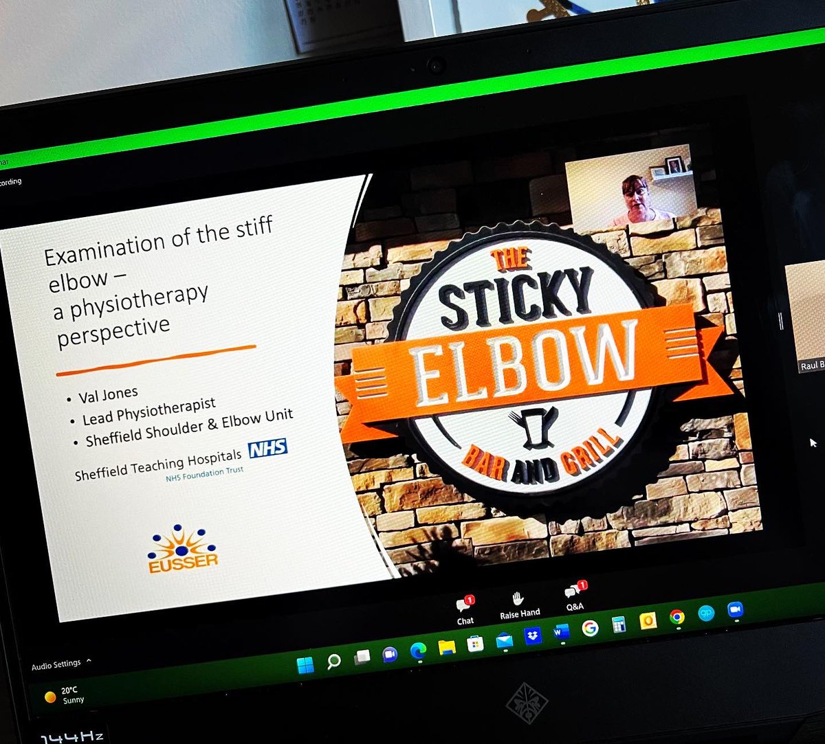 kriseh89's tweet photo. It’s an elbow evening! Thank you to all the speakers 🤓😀 @EUSSERBOARD @sececessse - always a pleasure to listen to fellow Physio @Valjones2305Val 💪 #alwayslearning #upperlimbadvancedpractitioner #physioapp https://t.co/CMvajFw6FP
