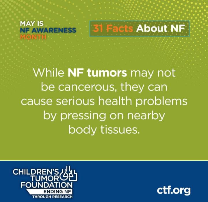RenieMoss's tweet photo. This is Philip’s tumor in 2012. This image was just taken 18 months after surgery to remove it. It threatened his airway, blood vessels, motor function, and vagus nerve.  This type of tumor has a 10-15% risk of turning malignant.  #benignisnotfine 
#ENDNF https://t.co/ezLKr14oRD