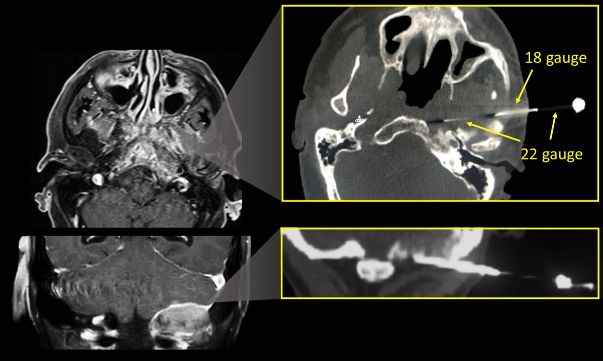 Lea Alhilali, MD tweet media